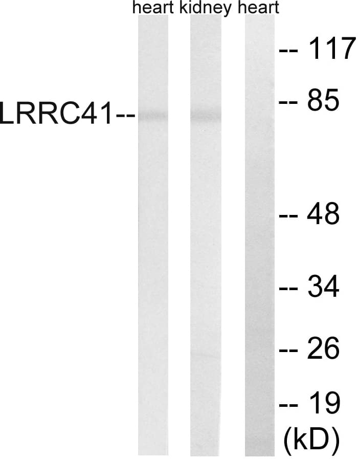 IHC-plus™ LRRC41 Antibody (aa391-440)