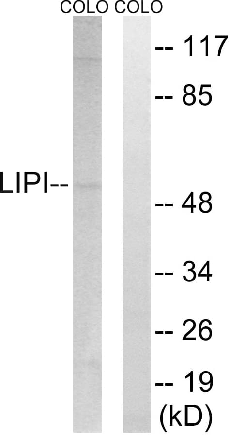 LIPI Antibody (aa289-338)