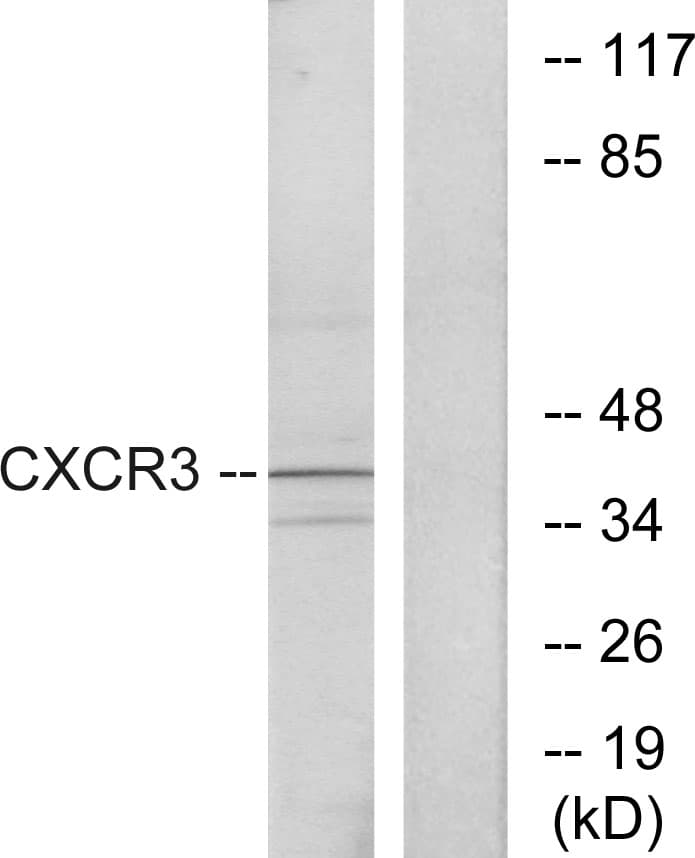 IHC-plus™ CXCR3 Antibody (aa161-210)