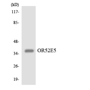 Polyclonal Rabbit anti-Human OR52E5 Antibody (WB)