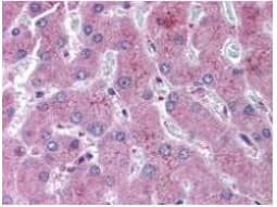 Polyclonal Rabbit anti-Human NOTCH2 Antibody (N-Terminus, IHC, WB)