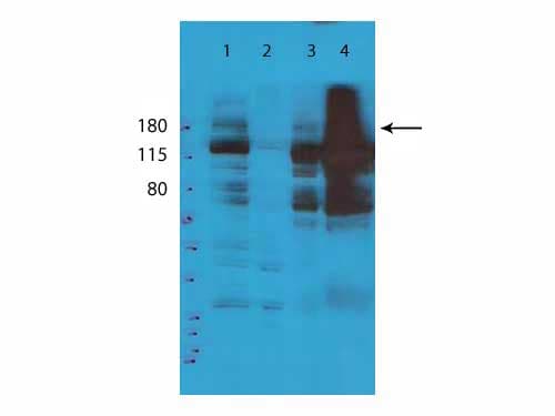 TET2 Antibody (aa1-156)