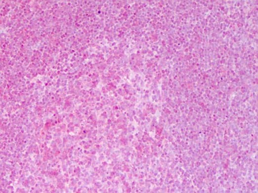 RELA / NFKB p65 Antibody (C-Terminus)
