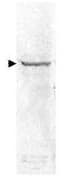 RELA / NFKB p65 Antibody (C-Terminus)