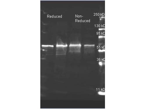 Choline Oxidase Antibody (Liquid)