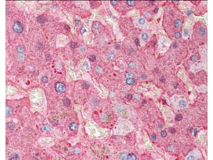 Fibrinogen Antibody (Lyophilized)