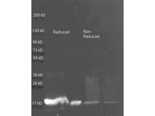 SERPINA1 / Alpha 1 Antitrypsin Antibody (Lyophilized, HRP)
