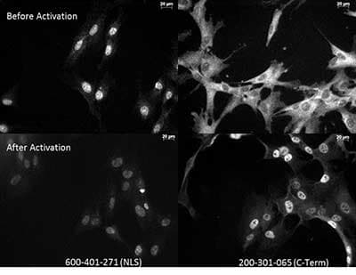 Monoclonal Mouse anti-Human RELA / NFKB p65 Antibody (clone 27F9.G4, C-Terminus, IHC, IF, WB)