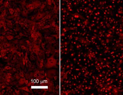 Monoclonal Mouse anti-Human RELA / NFKB p65 Antibody (clone 27F9.G4, C-Terminus, IHC, IF, WB)