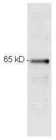 Monoclonal Mouse anti-Human RELA / NFKB p65 Antibody (clone 27F9.G4, C-Terminus, IHC, IF, WB)