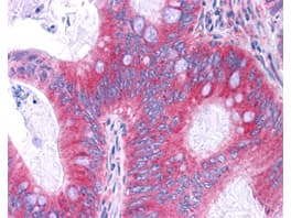 Monoclonal Mouse anti-Human RELA / NFKB p65 Antibody (clone 27F9.G4, C-Terminus, IHC, IF, WB)