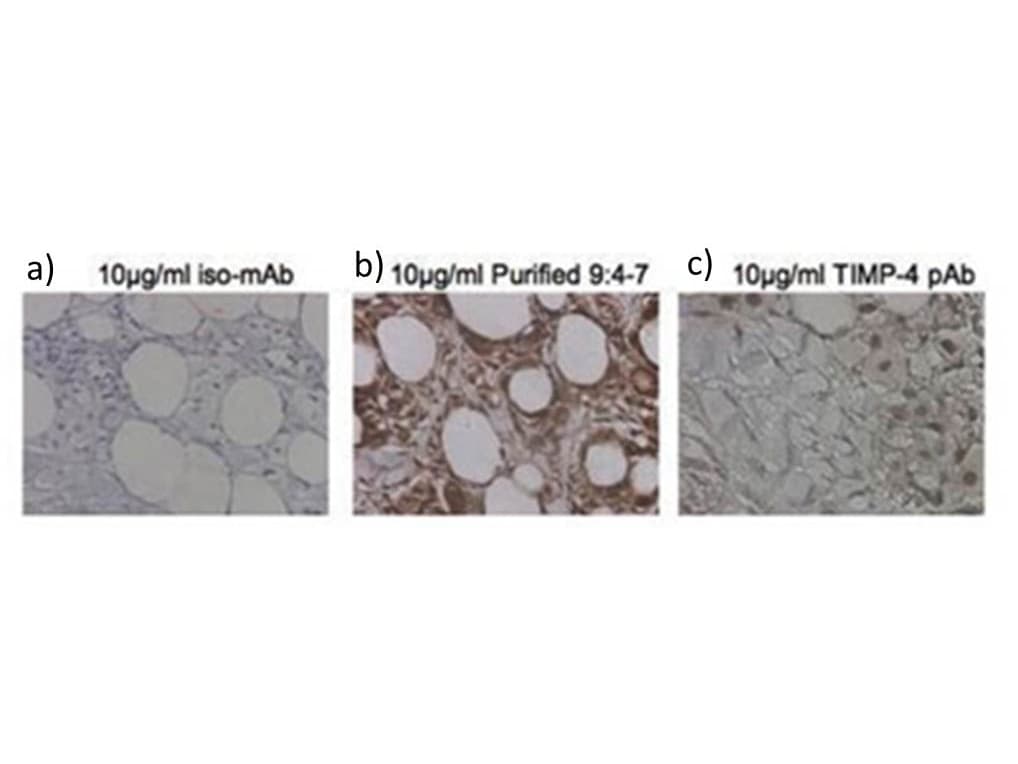 Monoclonal Mouse anti-Human TIMP4 Antibody (clone 9:4-7, IHC, WB)
