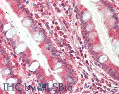 Monoclonal Mouse anti-Human TIMP4 Antibody (clone 9:4-7, IHC, WB)