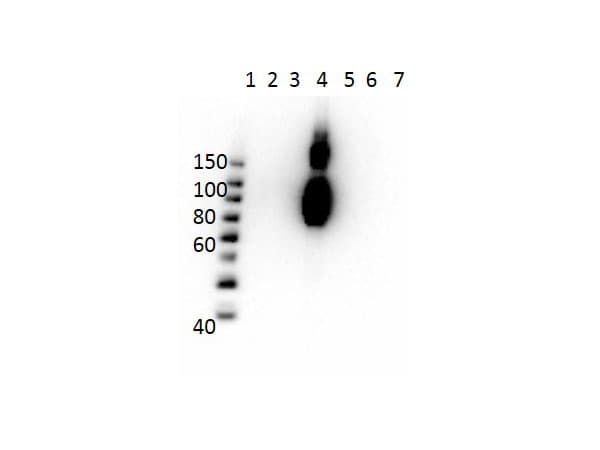 Monoclonal Mouse anti-Human Hemoglobin C Antibody (clone 15C2.C11.F2.G11, N-Terminus, WB)