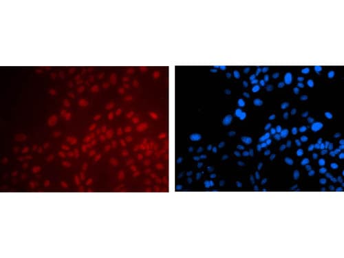 PAX6 Antibody (clone 7H10.D3.D4.G5)