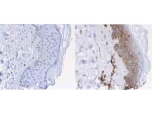 Polyclonal Rabbit anti-Human B2M / Beta 2 Microglobulin Antibody (Liquid, HRP, IHC, IF, WB)