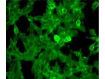 Polyclonal Rabbit anti-Human B2M / Beta 2 Microglobulin Antibody (Liquid, HRP, IHC, IF, WB)