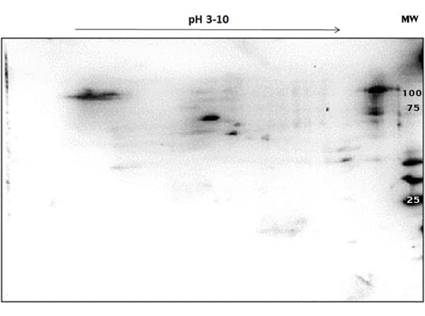 Polyclonal Rabbit anti-Human PARP1 Antibody (C-Terminus, WB)
