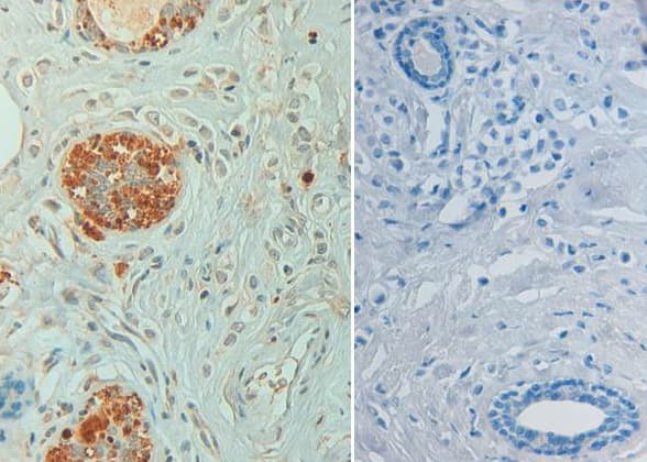 Polyclonal Rabbit anti-Human STAT6 Antibody (phospho-Tyr641, IHC, WB)