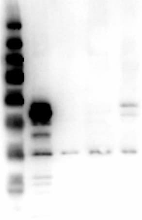 Polyclonal Rabbit anti-Human MAPK3 / ERK1 Antibody (N-Terminus, WB)