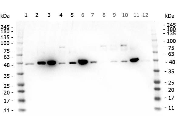 Polyclonal Rabbit anti-Human MAP2K1 / MKK1 / MEK1 Antibody (C-Terminus, IHC, WB)