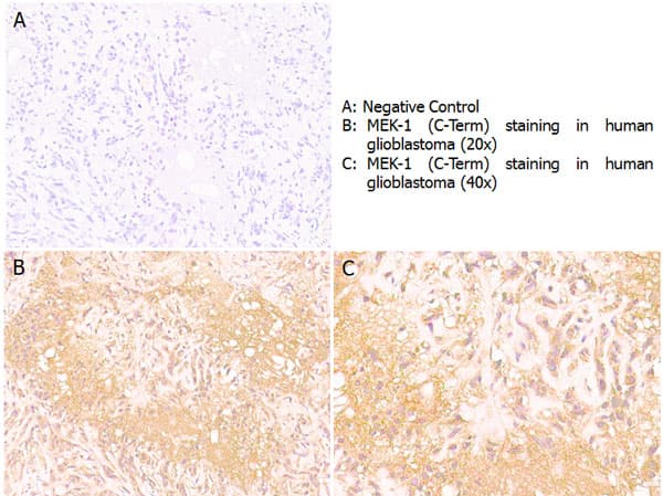 Polyclonal Rabbit anti-Human MAP2K1 / MKK1 / MEK1 Antibody (C-Terminus, IHC, WB)