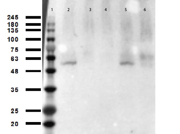 TP53 / p53 Antibody (Ac-Lys305)