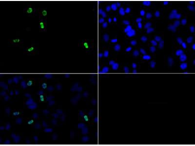 Polyclonal Rabbit anti-Human HIST3H3 Antibody (Asym-Me2-Arg2, IHC, IF, WB)