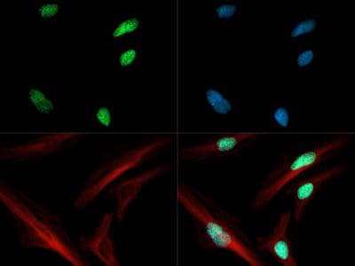 HIST3H3 Antibody (Ac-Lys4)