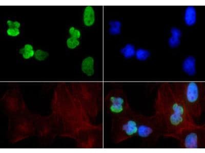 HIST3H3 Antibody (Ac-Lys9/14)