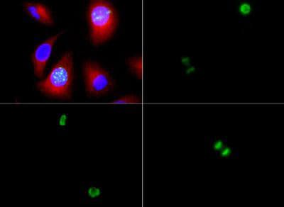 Polyclonal Rabbit anti-Human HIST3H3 Antibody (phospho-Ser10, IHC, IF, WB)