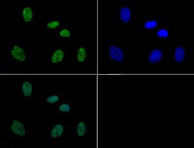 HIST3H3 Antibody (phospho-Ser10/pThr11)