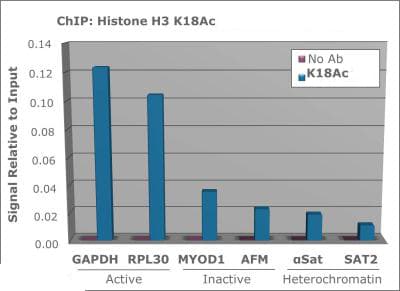 Polyclonal Rabbit anti-Human HIST3H3 Antibody (Ac-Lys18, IHC, IF, WB)