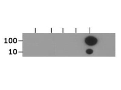 Polyclonal Rabbit anti-Human HIST3H3 Antibody (Ac-Lys18, IHC, IF, WB)