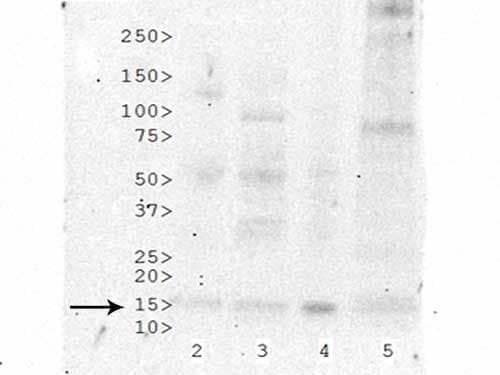 HIST3H3 Antibody (Ac-Lys27)