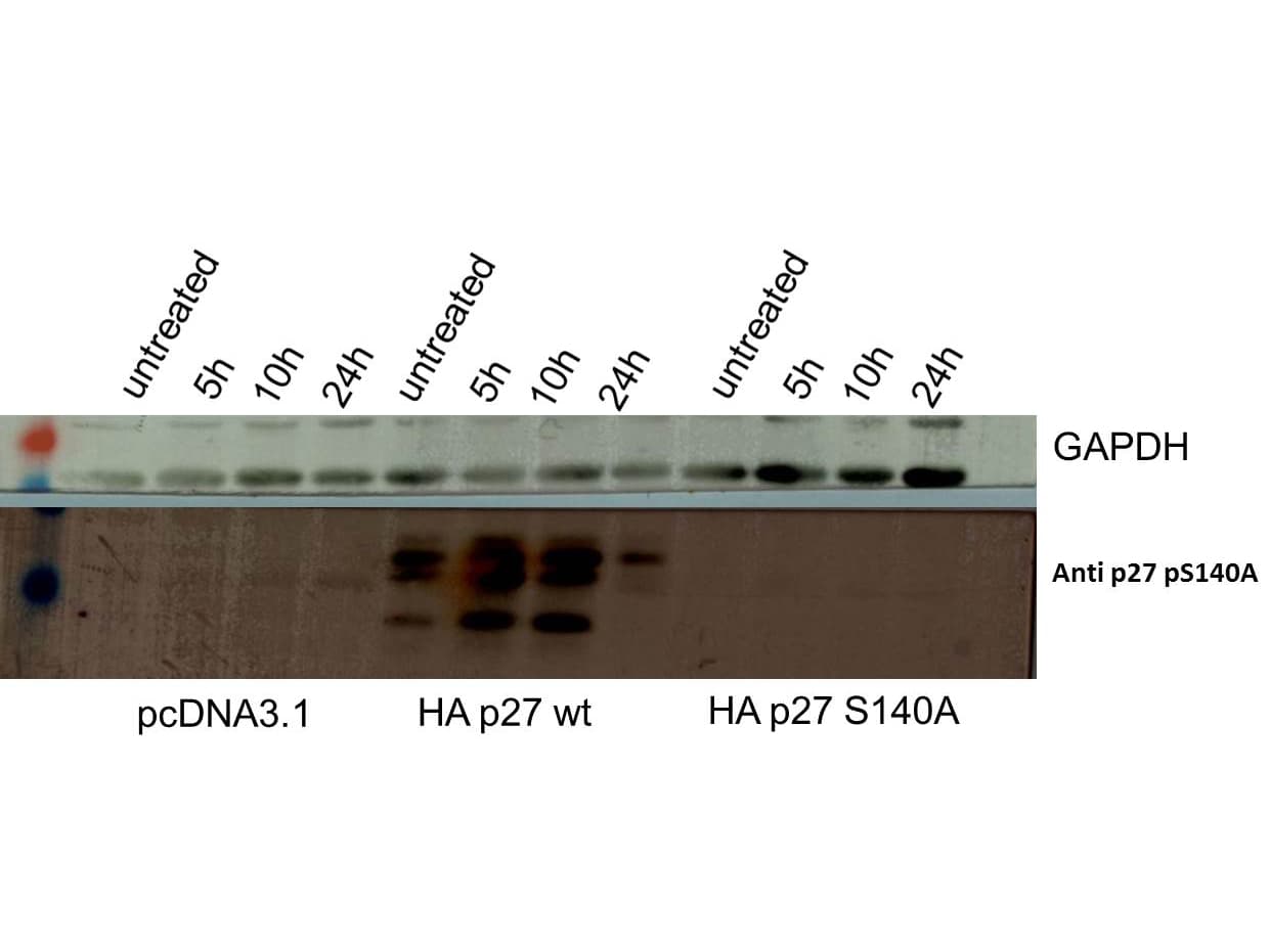 CDKN1B / p27 Kip1 Antibody (phospho-Ser140)