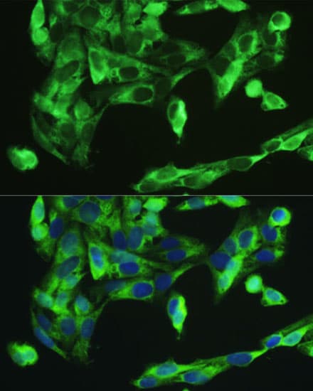 BMP2 Antibody