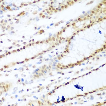 HDAC1 Antibody