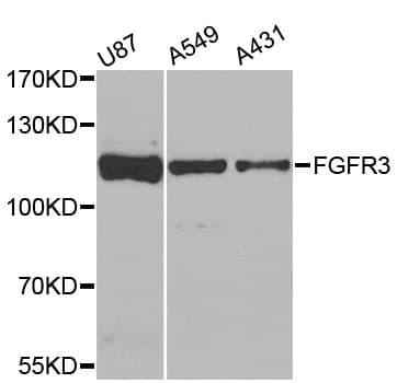 Polyclonal Rabbit anti-Human FGFR3 Antibody (IHC, WB)