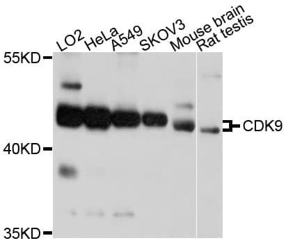 Polyclonal Rabbit anti-Human CDK9 Antibody (IHC, WB)