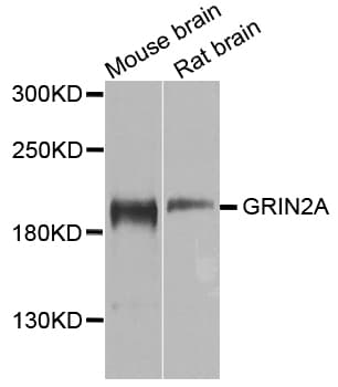 Polyclonal Rabbit anti-Human GRIN2A / NMDAR2A / NR2A Antibody (IHC, WB)
