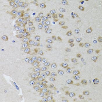 Polyclonal Rabbit anti-Human GRIN2A / NMDAR2A / NR2A Antibody (IHC, WB)