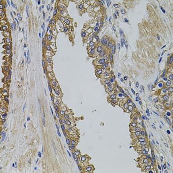 Polyclonal Rabbit anti-Human PIK3C3 / VPS34 Antibody (IHC, WB)