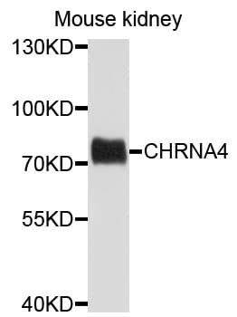 Polyclonal Rabbit anti-Human CHRNA4 / NACHR Antibody (WB)