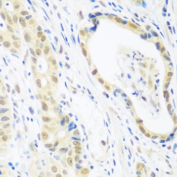 POLR2E Antibody
