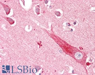 Polyclonal Rabbit anti-Human CD200 Antibody (IHC, WB)