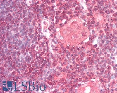 Polyclonal Rabbit anti-Human CD200 Antibody (IHC, WB)