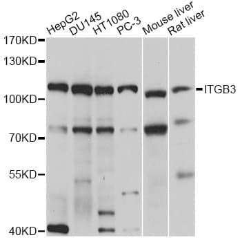 Polyclonal Rabbit anti-Human ITGB3 / Integrin Beta 3 / CD61 Antibody (WB)