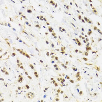 Polyclonal Rabbit anti-Human RAD50 Antibody (IHC, WB)