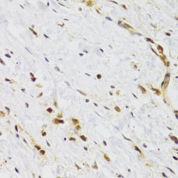 Polyclonal Rabbit anti-Human RAD50 Antibody (IHC, WB)